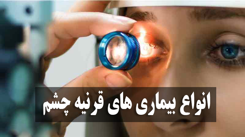 انواع بیماری های قرنیه چشم