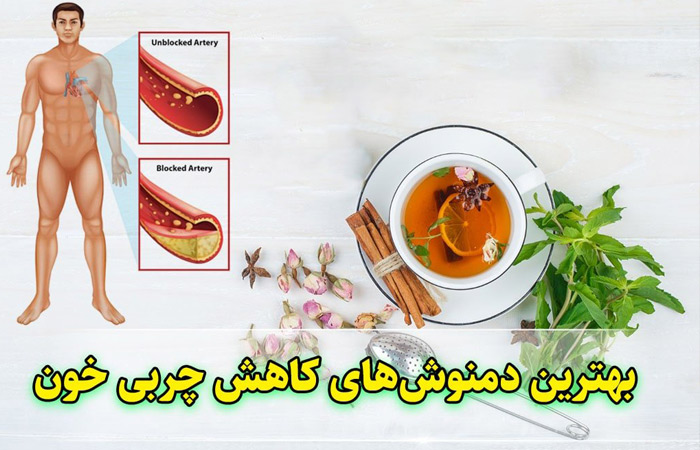 کاهش کلسترول و تری گلیسیرید با طب سنتی