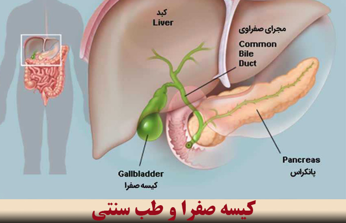 کیسه صفرا و طب سنتی ✔️ صفرا چیست و چه علائمی دارد ✔️  عملکرد کیسه صفرا ✔️  انسداد کیسه صفرا یعنی چه ✔️ دلیل زیاد شدن صفرا در بدن ✔️ علائم کیسه صفرا ✔️ درمان سنگ صفرا با طب سنتی