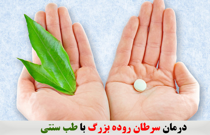 درمان سرطان روده بزرگ با طب سنتی