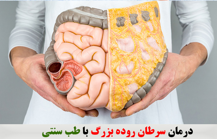 درمان سرطان روده بزرگ با طب سنتی