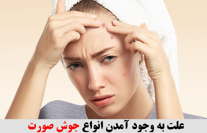 علت به وجود آمدن انواع جوش صورت 