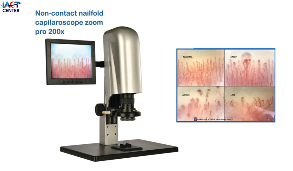 nailfold capillaroscope